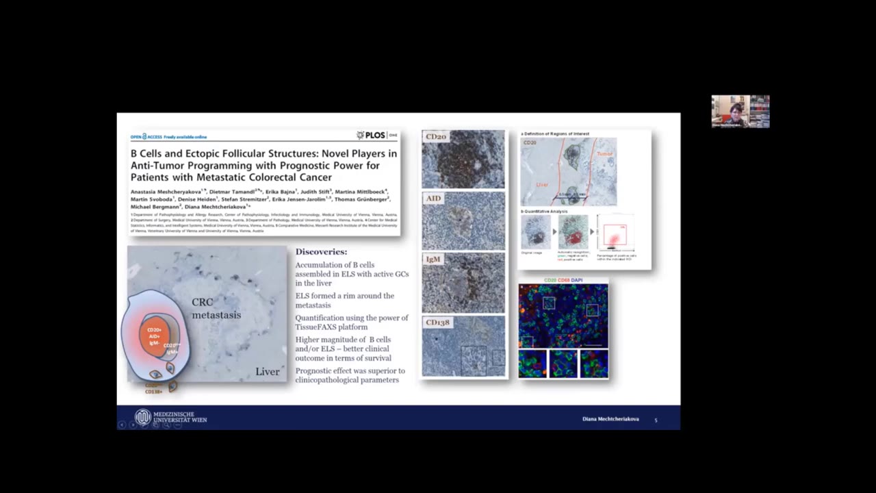 B Cells and ELS in CRCLM